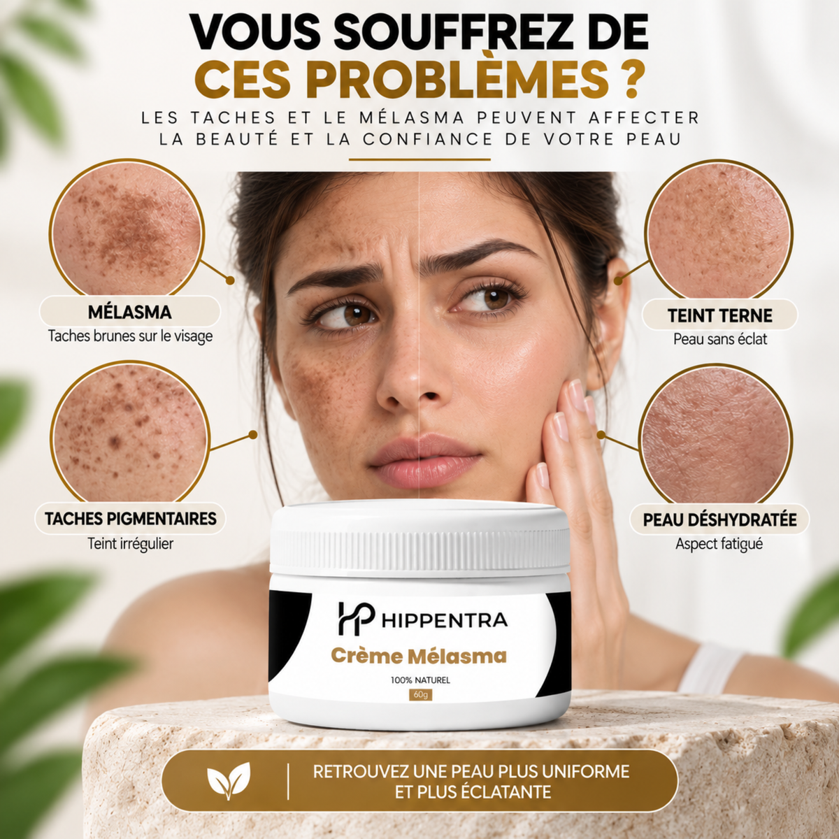 HIPPENTRA® Crème Mélasma – Soin Unifiant & Éclat – 60 g