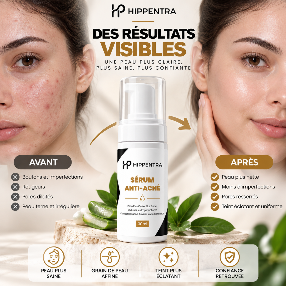 HIPPENTRA® Sérum Anti-Acné – 30 ml