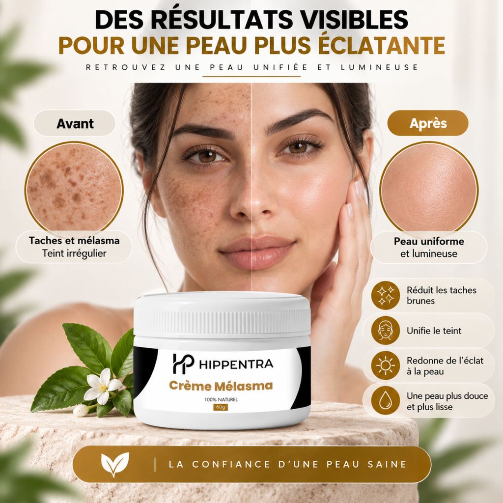 HIPPENTRA® Crème Mélasma – Soin Unifiant & Éclat – 60 g
