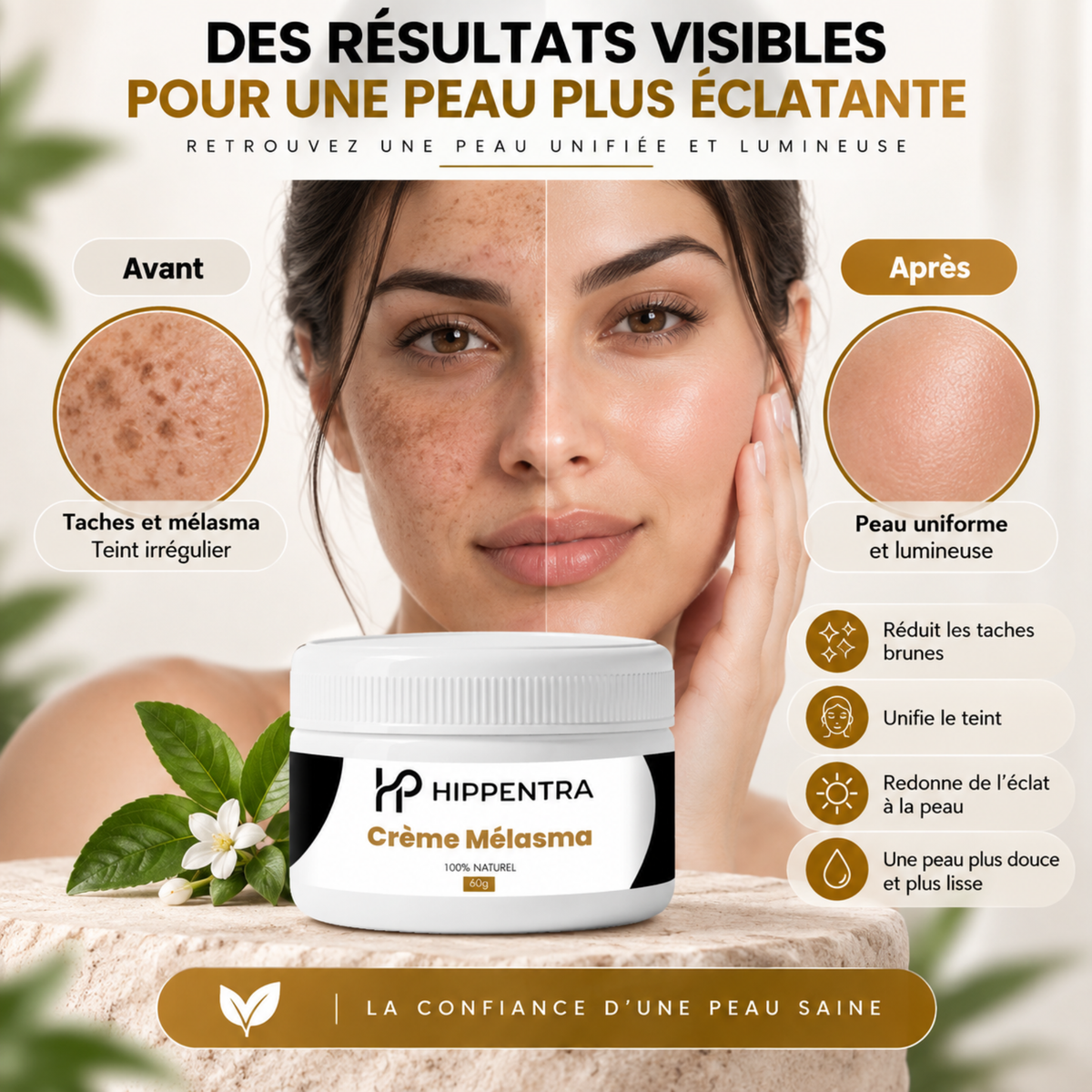 HIPPENTRA® Crème Mélasma – Soin Unifiant & Éclat – 60 g