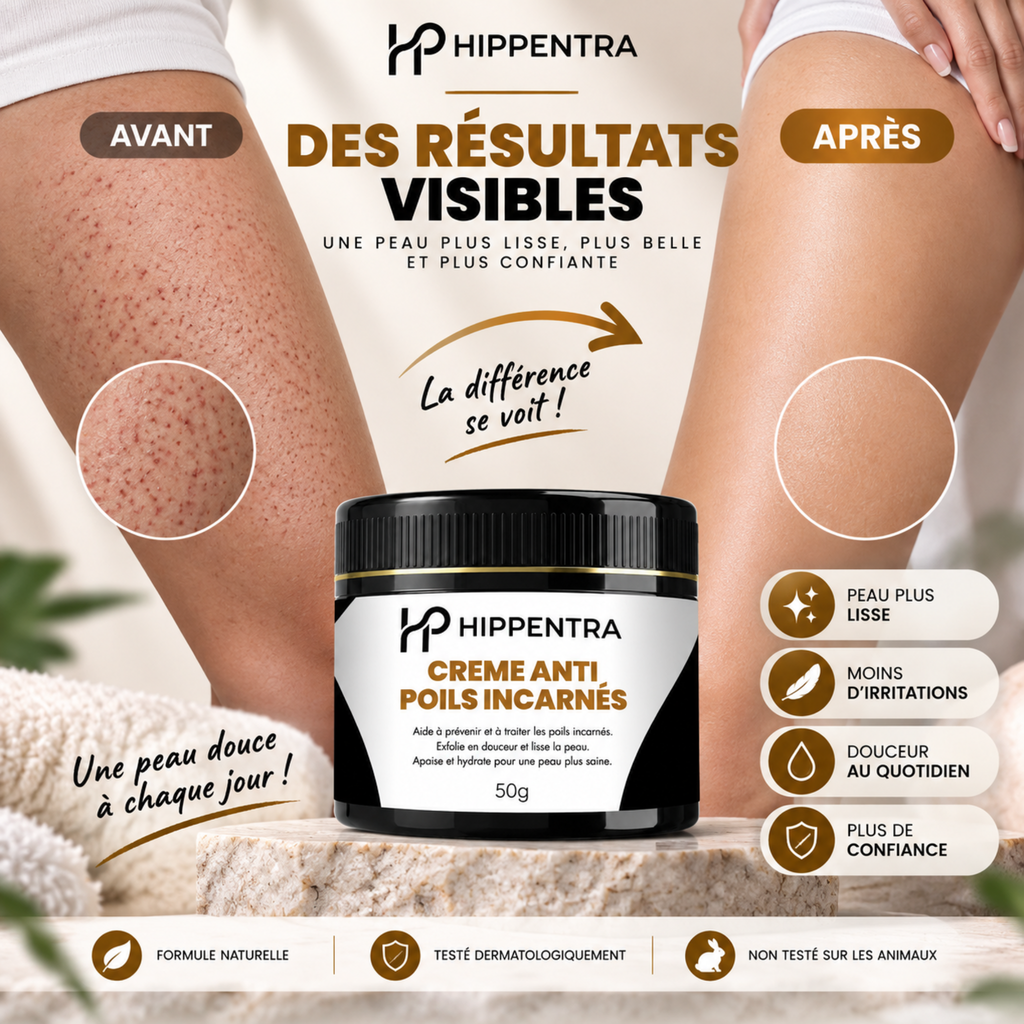 HIPPENTRA® Crème Anti-Poils Incarnés – 50 g